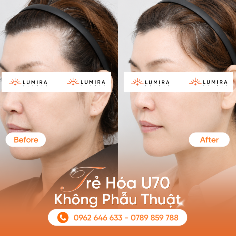 Cách trẻ hóa làn da hiệu quả