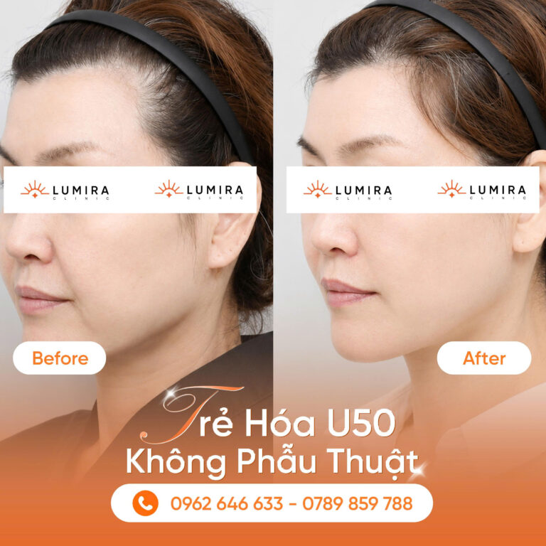 Cách trẻ hóa làn da hiệu quả
