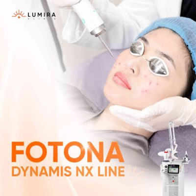 Laser Fotona Dynamix NX Line là gì