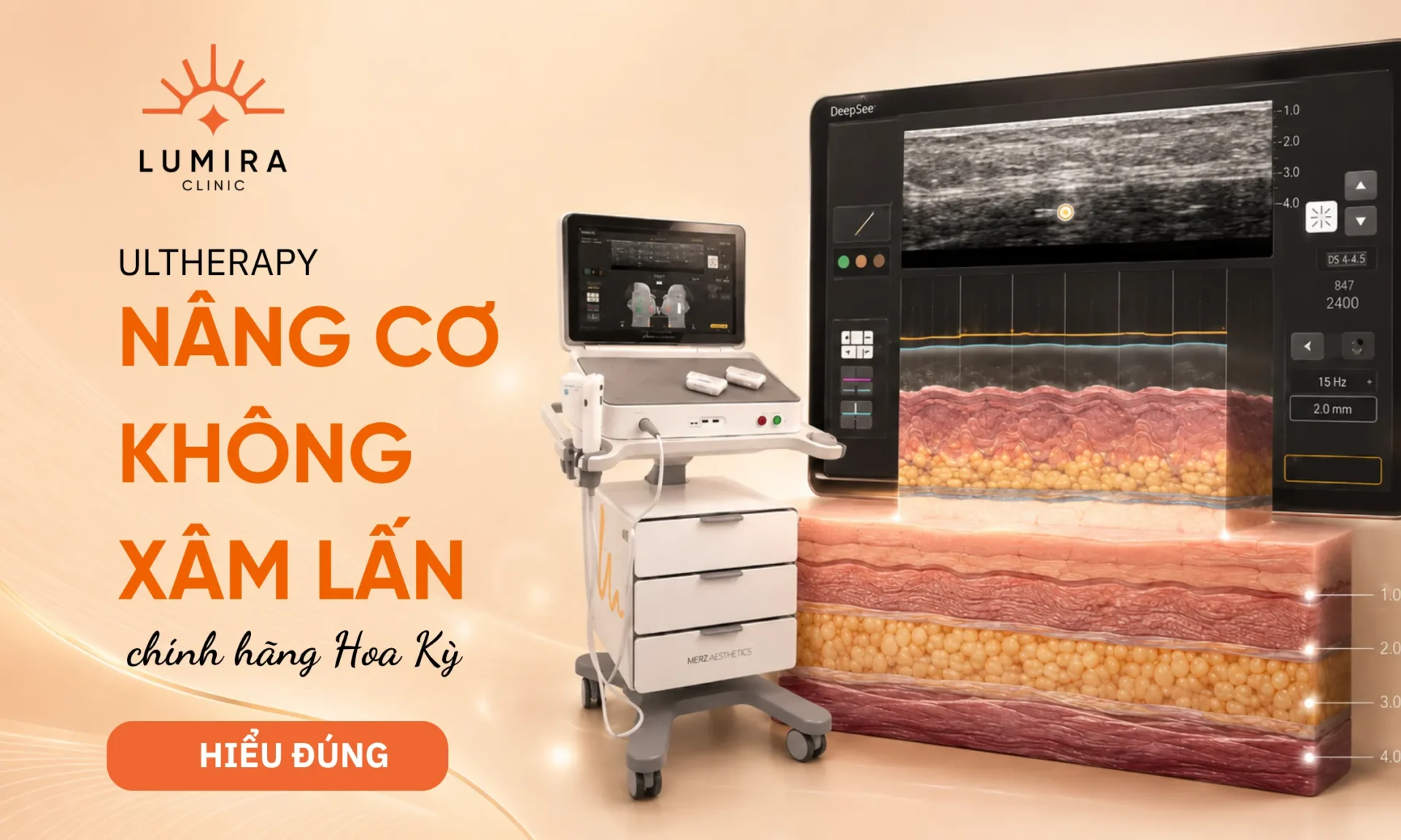 Minh họa ultherapy là gì? công nghệ nâng cơ không xâm lấn và trường hợp phù hợp - Lumira Clinic