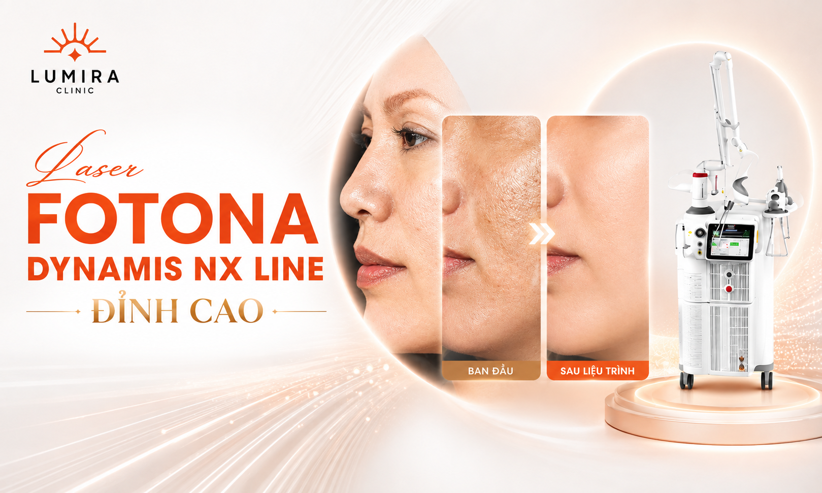 Laser Fotona Dynamis NX Line