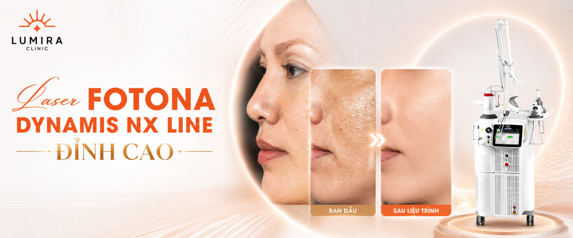 Laser Fotona Dynamis NX Line