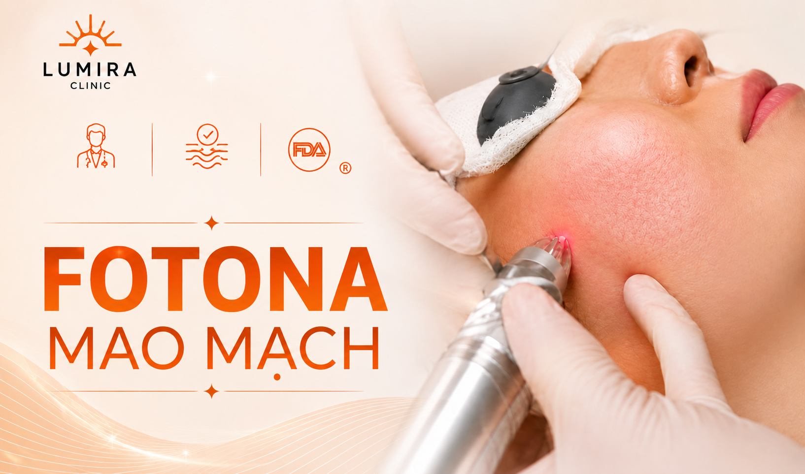 Điều Trị Giãn Mao Mạch Laser Fotona