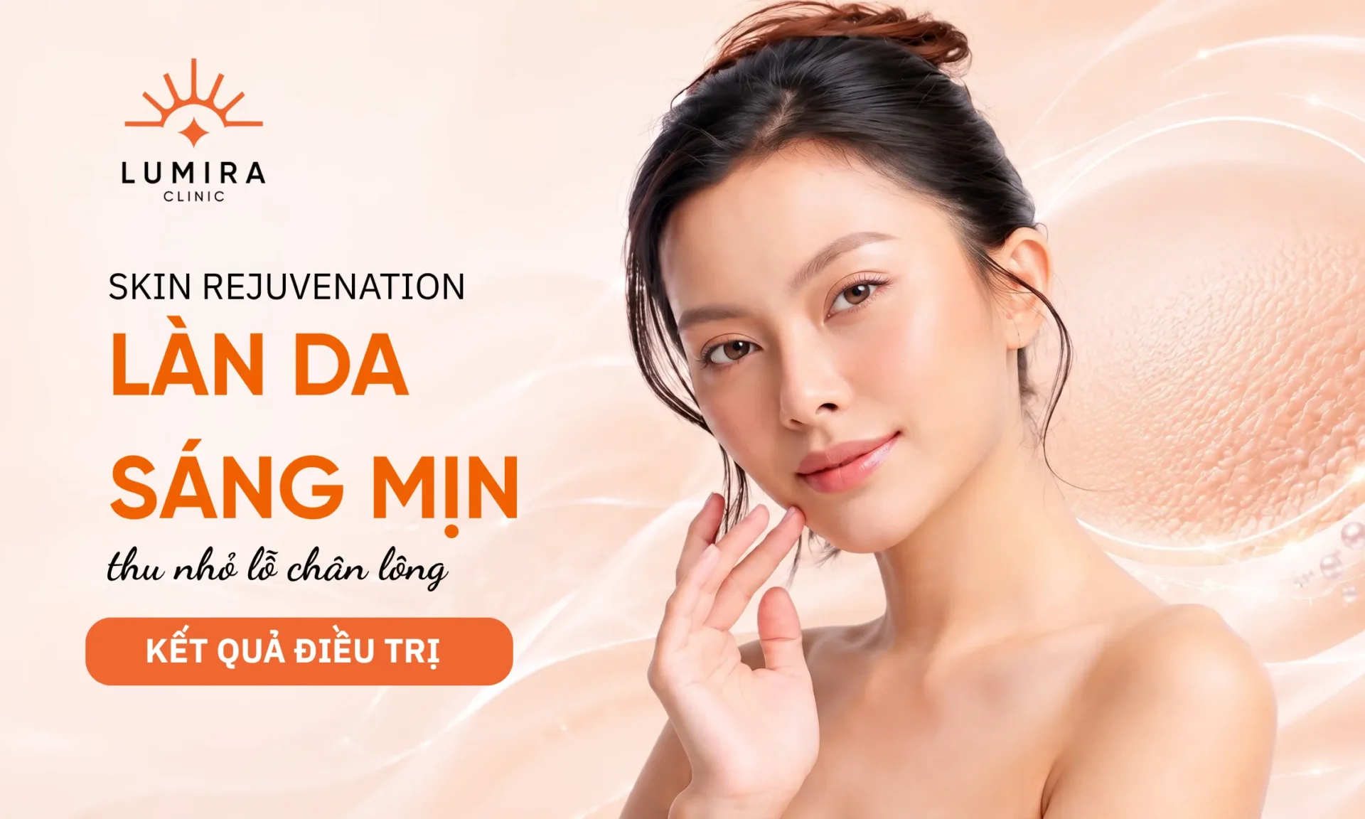 Minh họa tư vấn Fotona tại Lumira