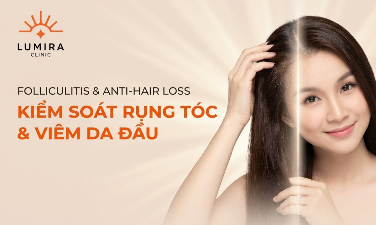 Điều Trị Viêm Nang Lông & Kiểm Soát Rụng Tóc
