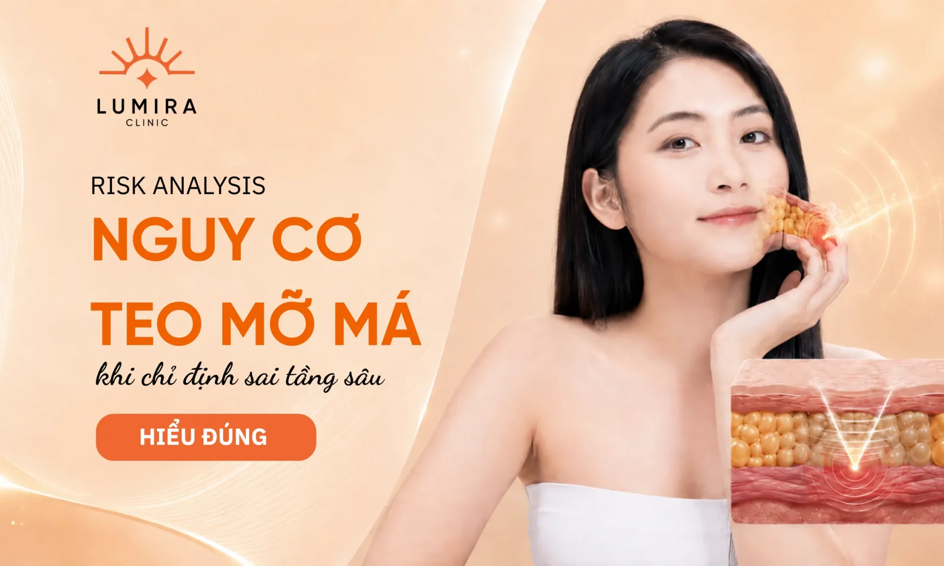 Ultherapy có làm tiêu mỡ má không?