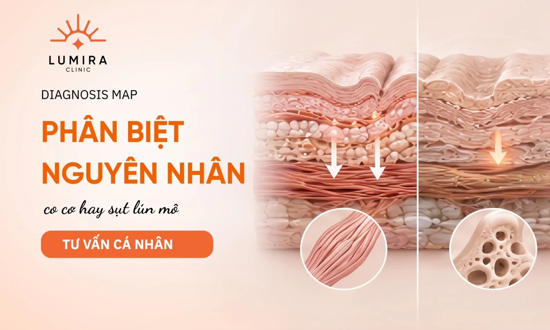 Rãnh cười là gì? Nguyên nhân và cách cải thiện theo từng trường hợp - minh họa tư vấn y khoa Lumira