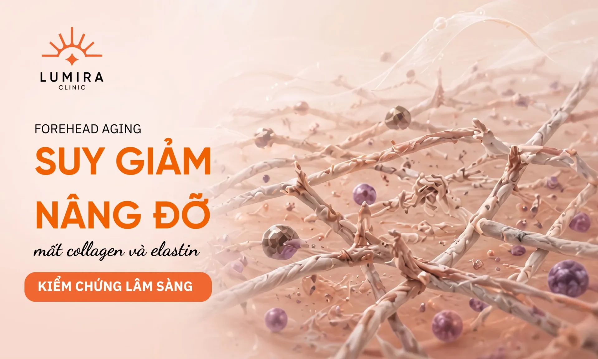 Trán Xuất Hiện Nếp Nhăn Ngang: Nguyên Nhân Và Dấu Hiệu Lão Hóa Sớm