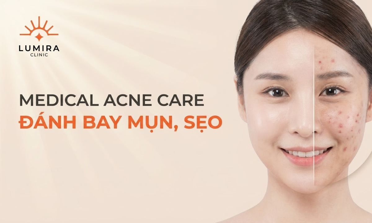 TRỊ MỤN & SẸO RỔ