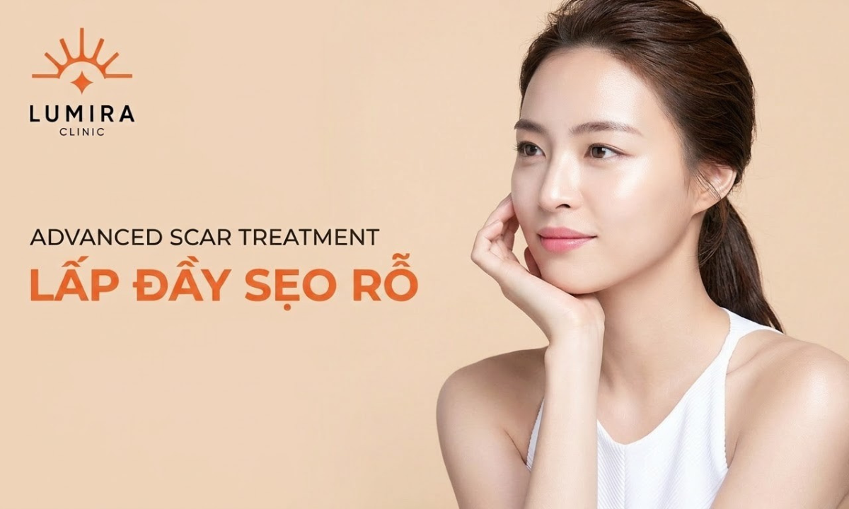 Điều Trị Sẹo Rỗ Bằng Tách Đáy, Laser & PRP