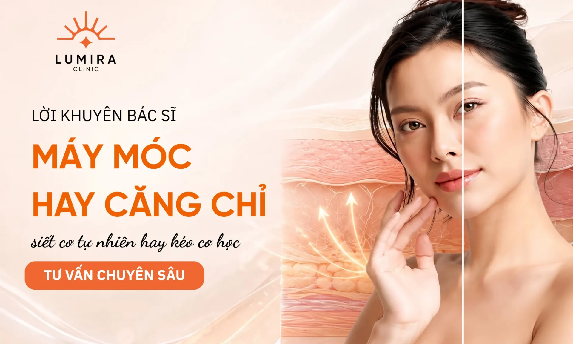 Phân định rõ ràng: Căng chỉ khác gì với công nghệ nâng cơ?