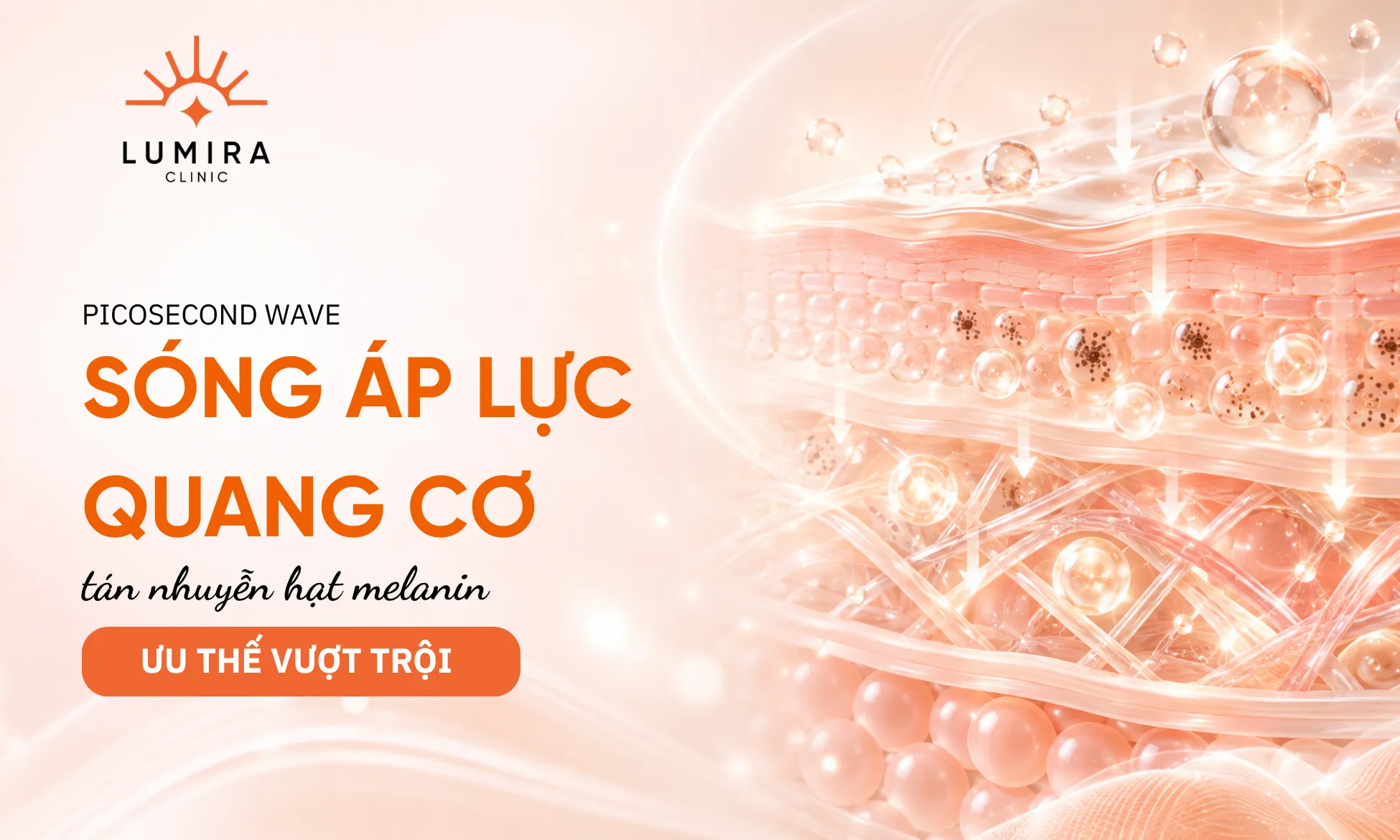 Cơ chế sóng áp lực quang cơ pico giây tán mịn hạt sắc tố nám tại Lumira Clinic
