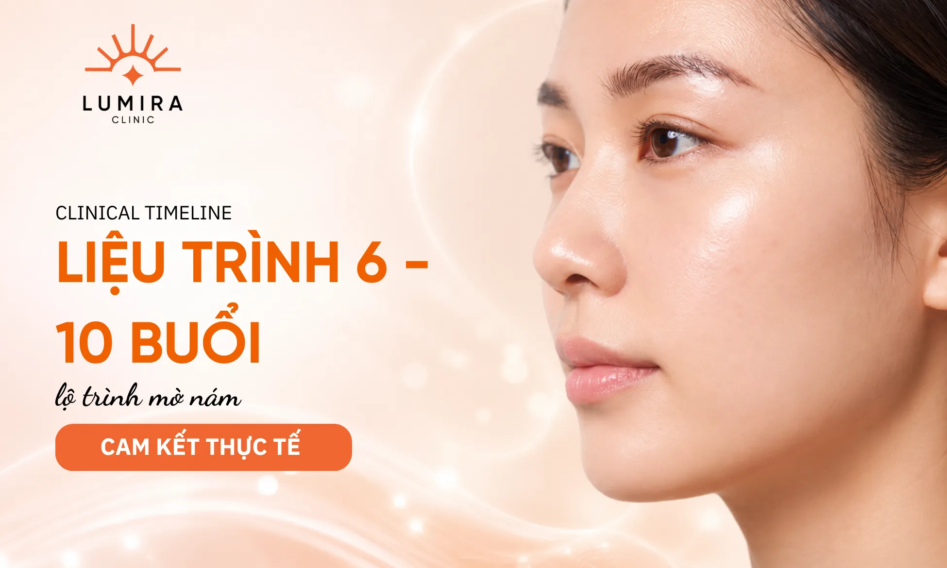 Lộ trình đáp ứng lâm sàng thực tế theo số buổi điều trị nám bằng Laser Discovery Pico Plus