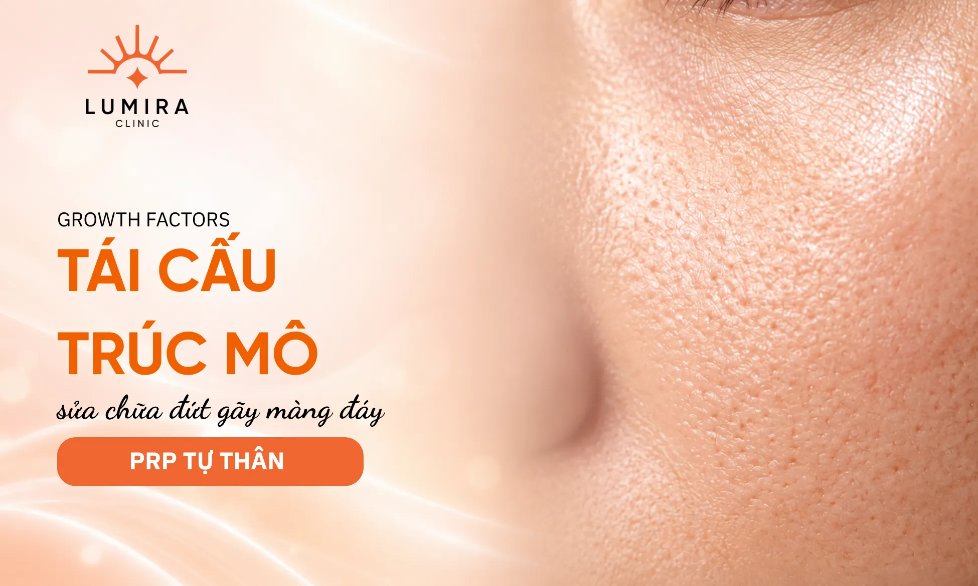 Cơ chế giải phóng yếu tố tăng trưởng PDGF và TGF-beta từ huyết tương giàu tiểu cầu PRP phục hồi da nám