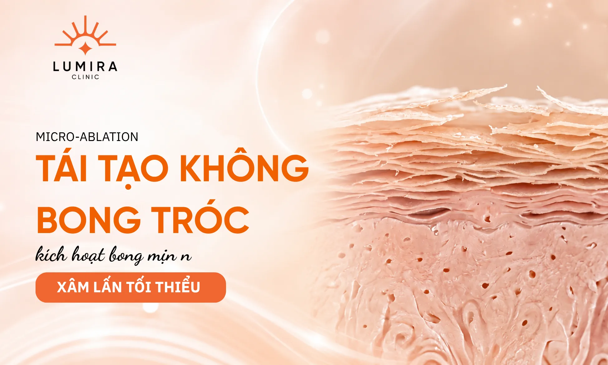 Cơ chế bóc tách vi điểm lớp sừng sắc tố và bảo tồn màng ẩm tự nhiên với Fotona Peel