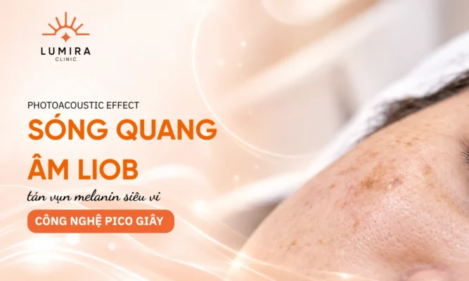 Cơ chế sóng quang âm LIOB cực ngắn của Laser Discovery Pico Plus phá vỡ sắc tố melanin