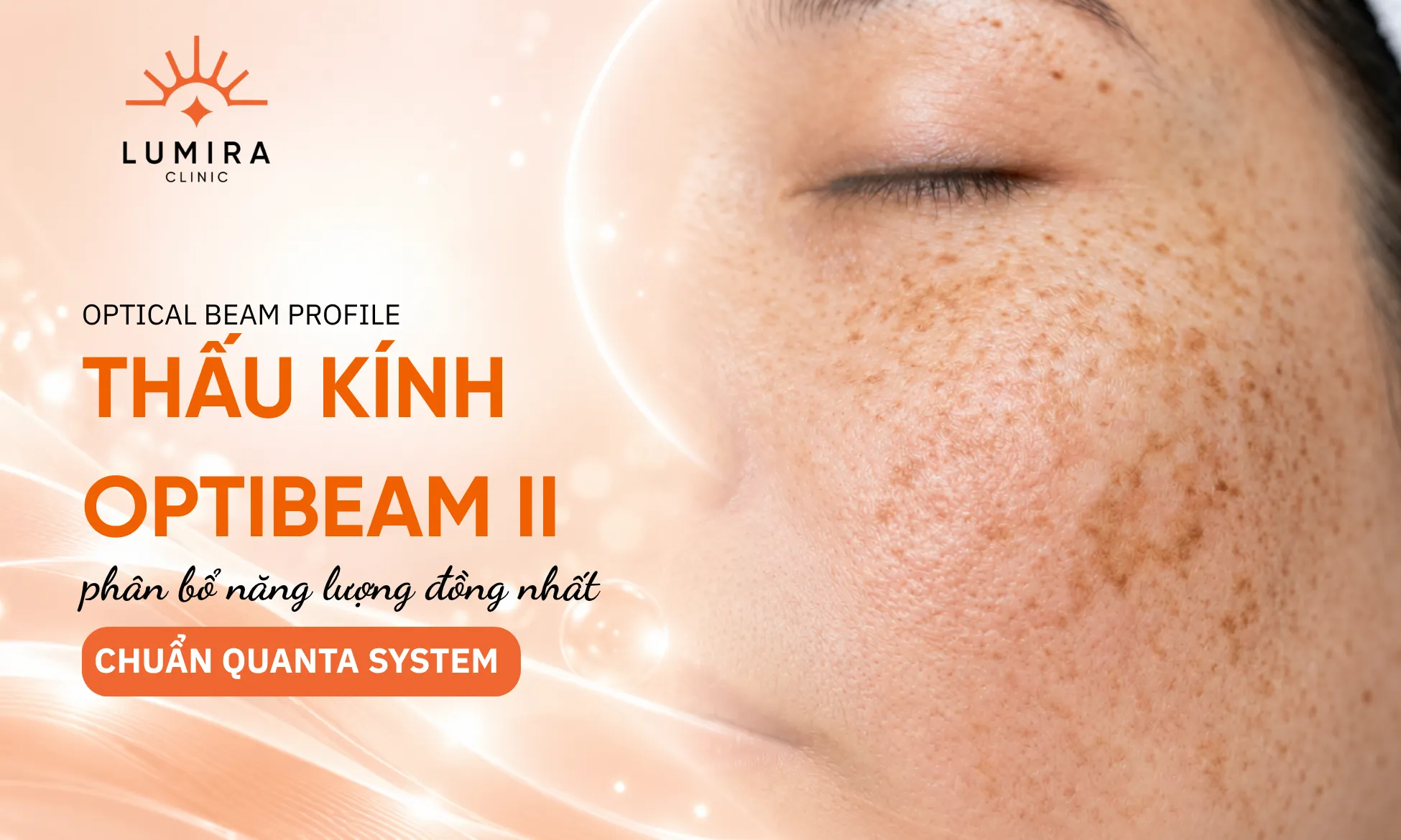 Tay khoan vi điểm Optibeam II chùm tia Flat-Top của thiết bị Laser Discovery Pico Plus Ý