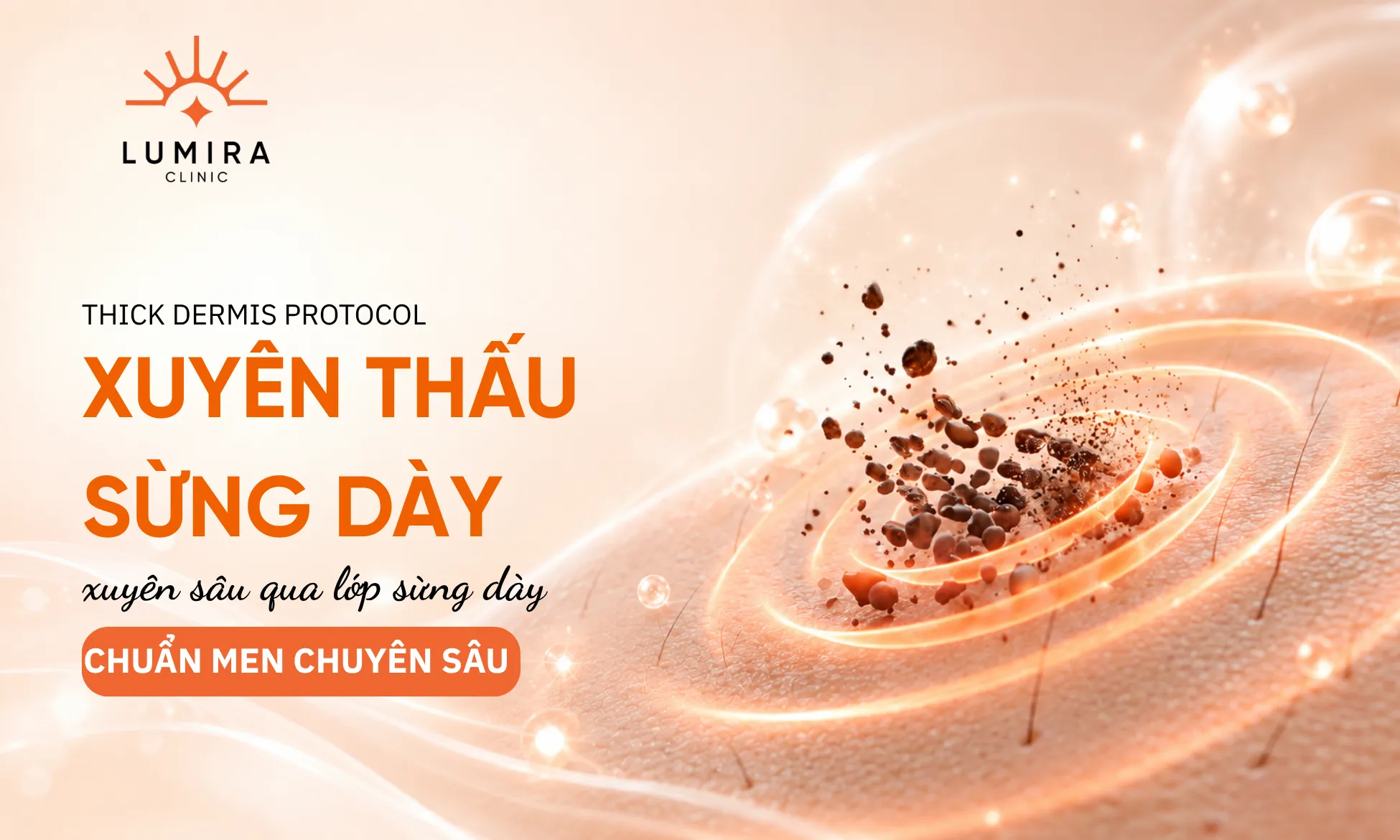 Giải pháp laser xung pico điều trị nám da chân sâu cho nam giới tại Lumira Clinic