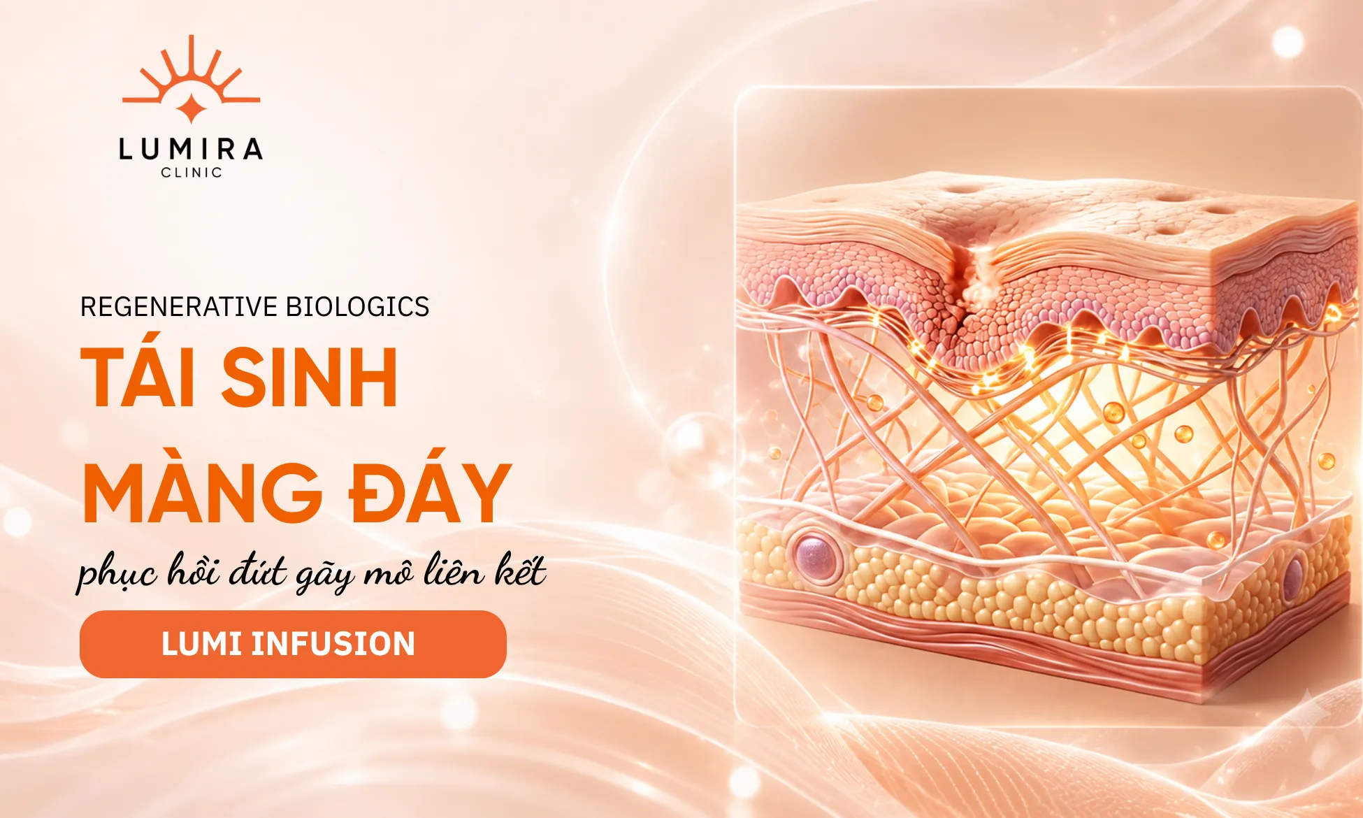 Liệu pháp Lumi Infusion và PRP tự thân phục hồi màng đáy trong phác đồ trị nám Lumira