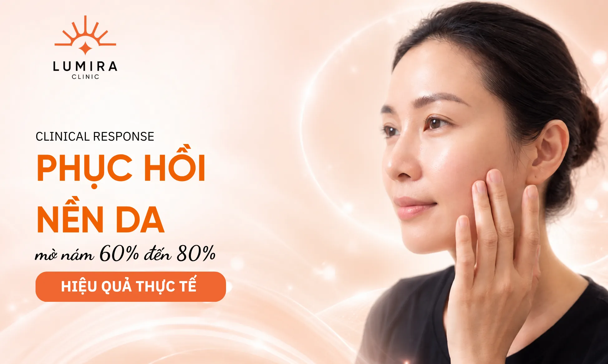 Kết quả cải thiện sắc tố và phục hồi nền da dày khỏe sau phác đồ chuẩn y khoa tại Lumira Clinic