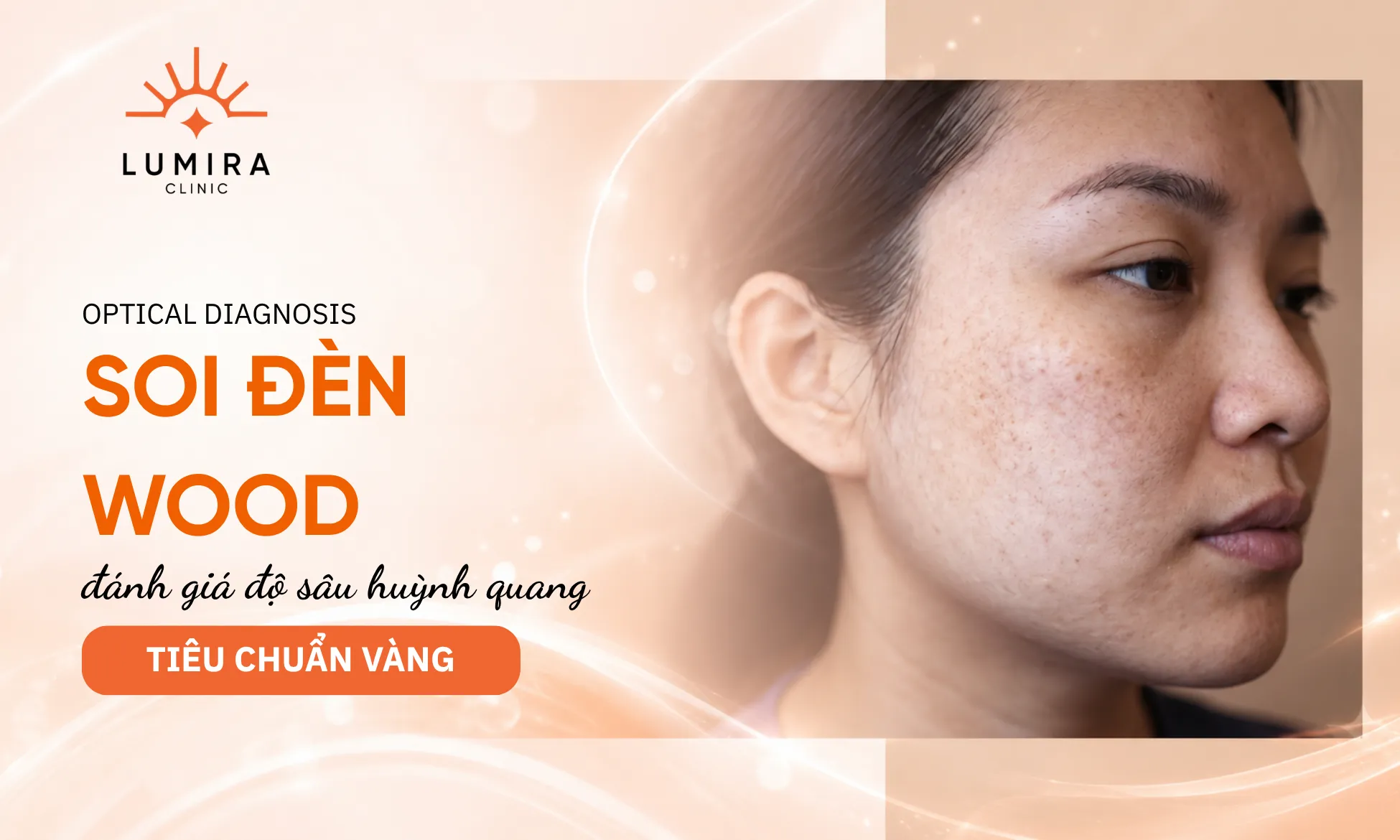 Khám soi da phân tầng sắc tố dưới ánh sáng đèn soi da huỳnh quang Wood và thiết bị soi da chuyên sâu