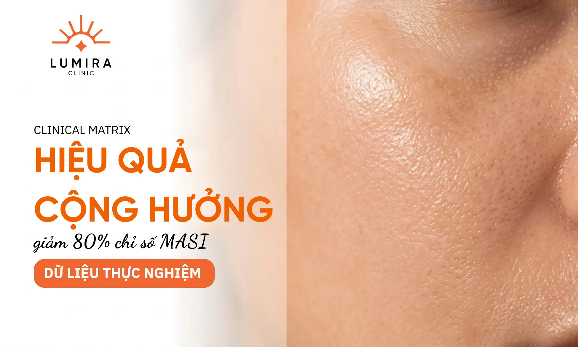Dữ liệu thực nghiệm lâm sàng cải thiện chỉ số MASI khi kết hợp bộ đôi Tranexamic Acid và Niacinamide