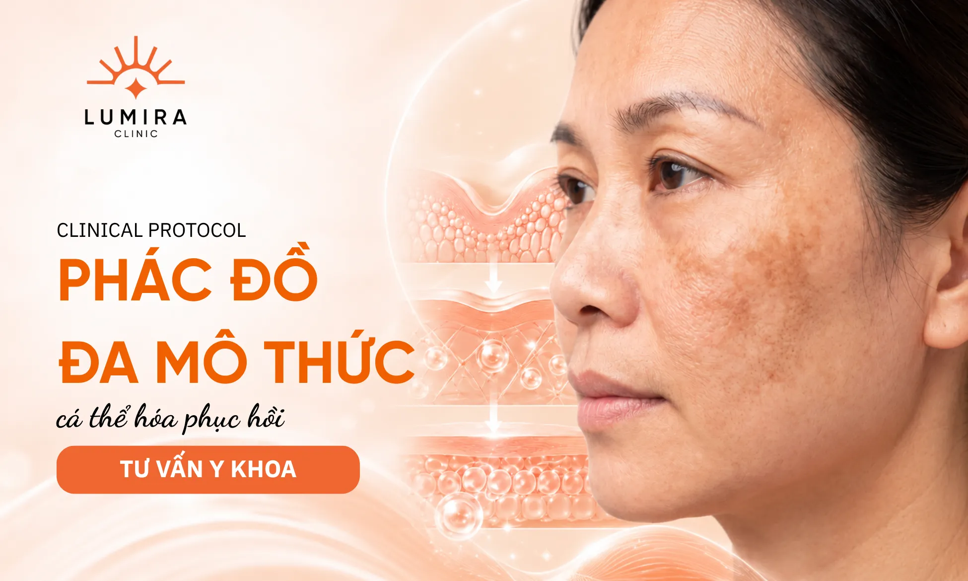 Hình ảnh lâm sàng thực tế nền da nám và phác đồ phục hồi màng đáy đa mô thức chuẩn y khoa