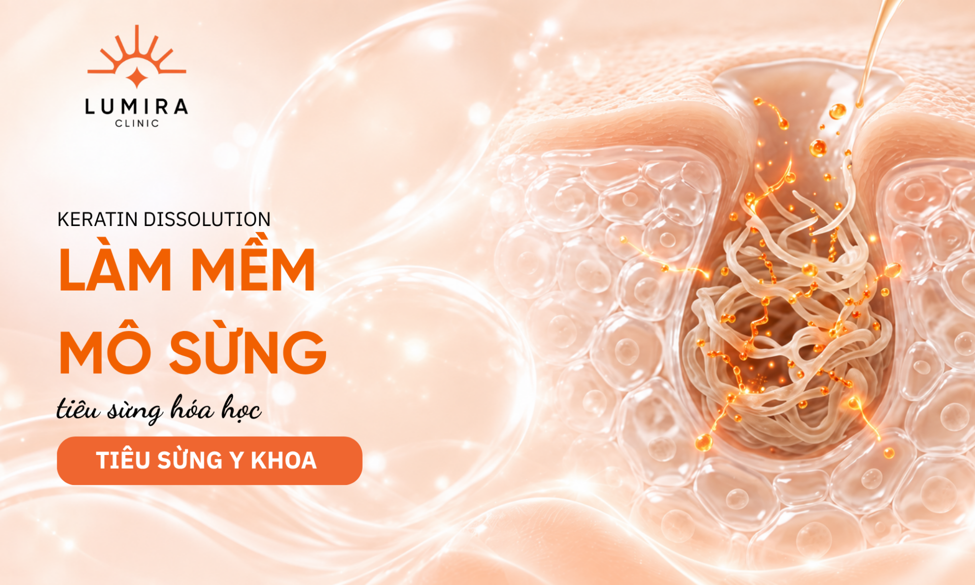 Co che lam mem va giai phong nhan mun chai khong dau - Lumira Clinic