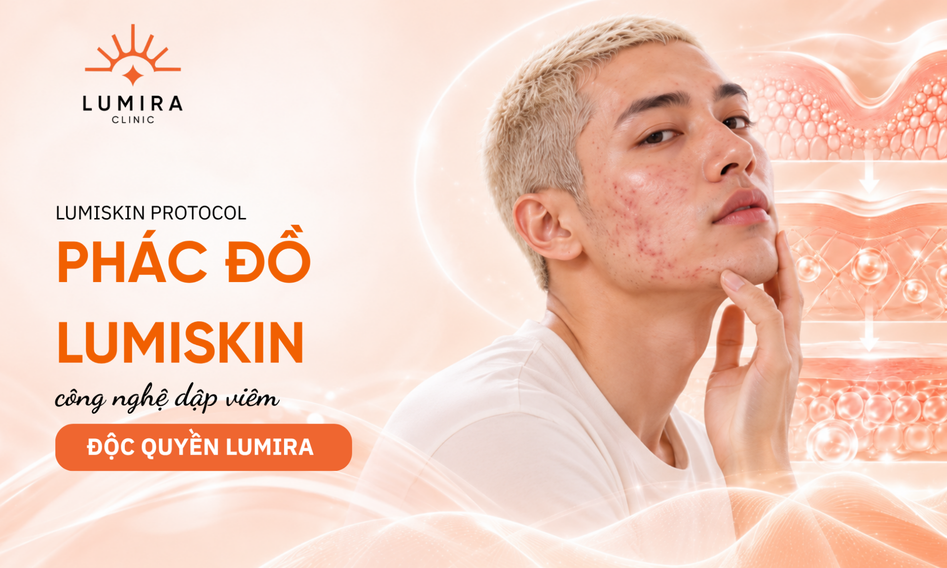Phong dieu tri da lieu voi he thong may LDM Pro va Laser Fotona tai Lumira Clinic