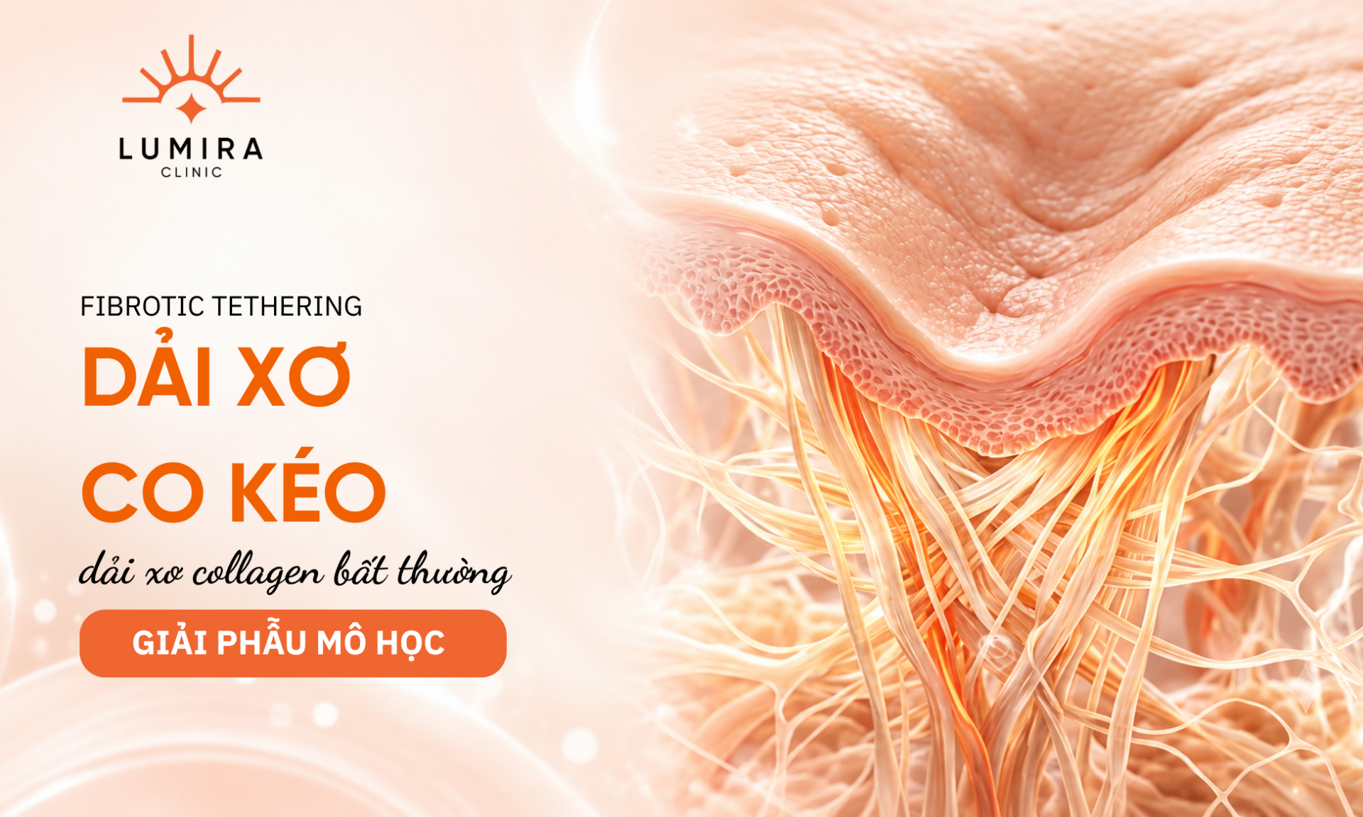 Co che dai xo co keo keo lom day seo ro trung bi - Lumira Clinic