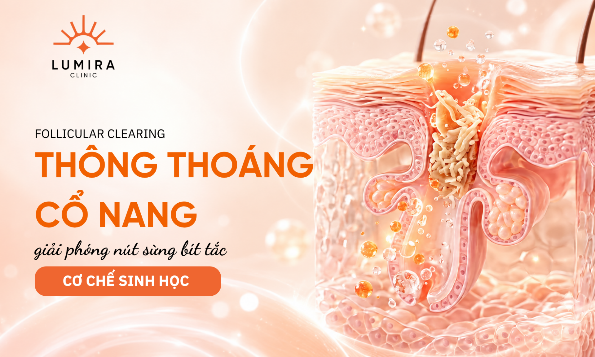 Co che giai phong nut sung co nang long thong thoang lo thoat ba nhon - Lumira Clinic