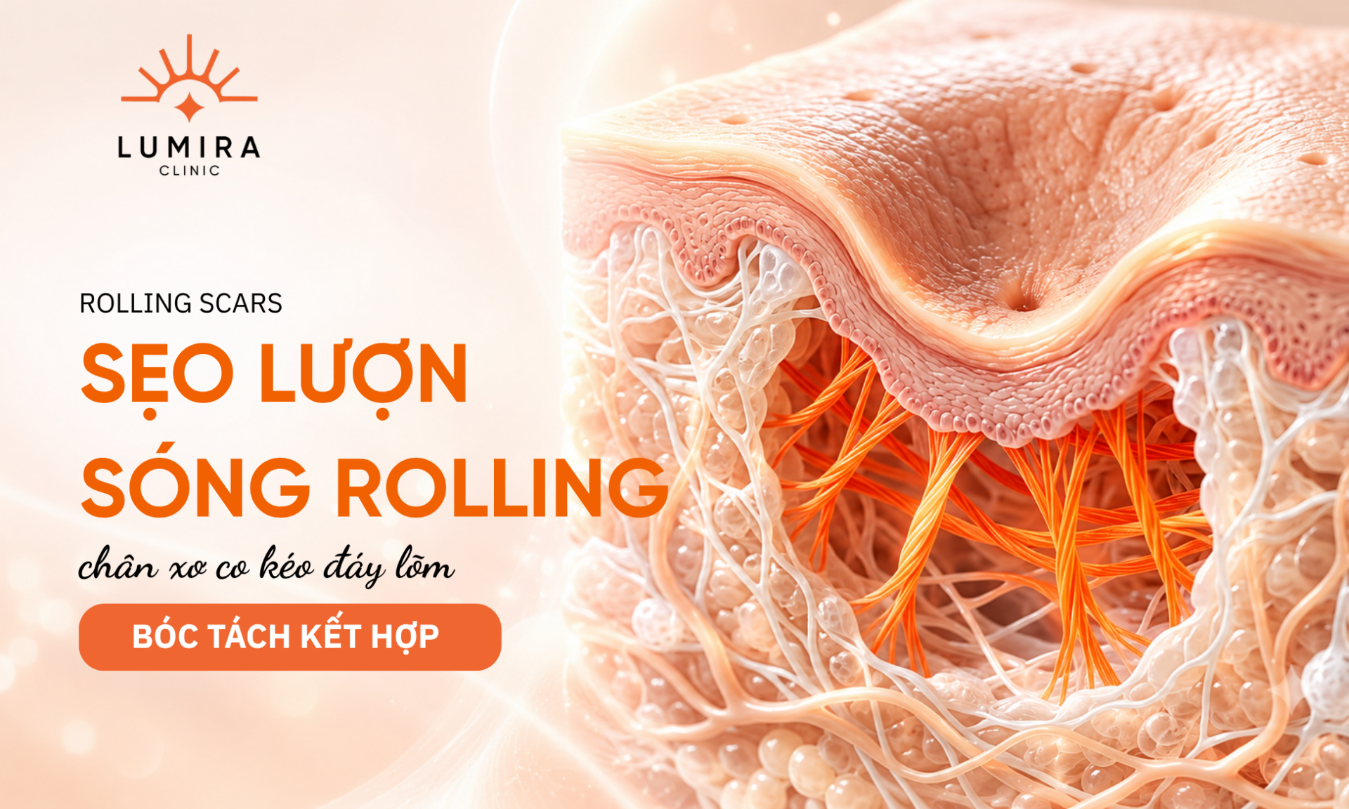 Hinh anh seo luon song Rolling Scar va phac do cat day seo ket hop PRP - Lumira Clinic