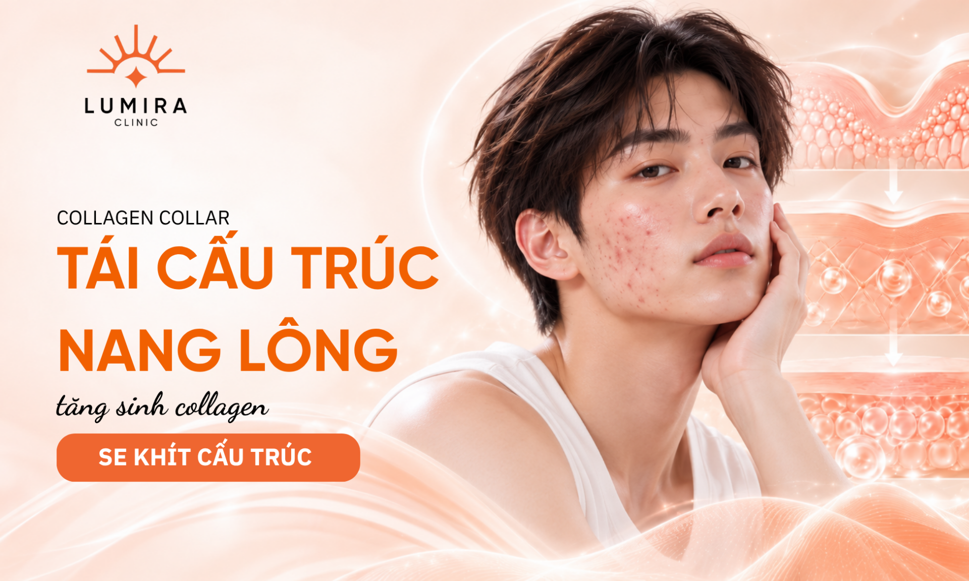 Mang luoi collagen tang sinh nang do co nang long se khit - Lumira Clinic