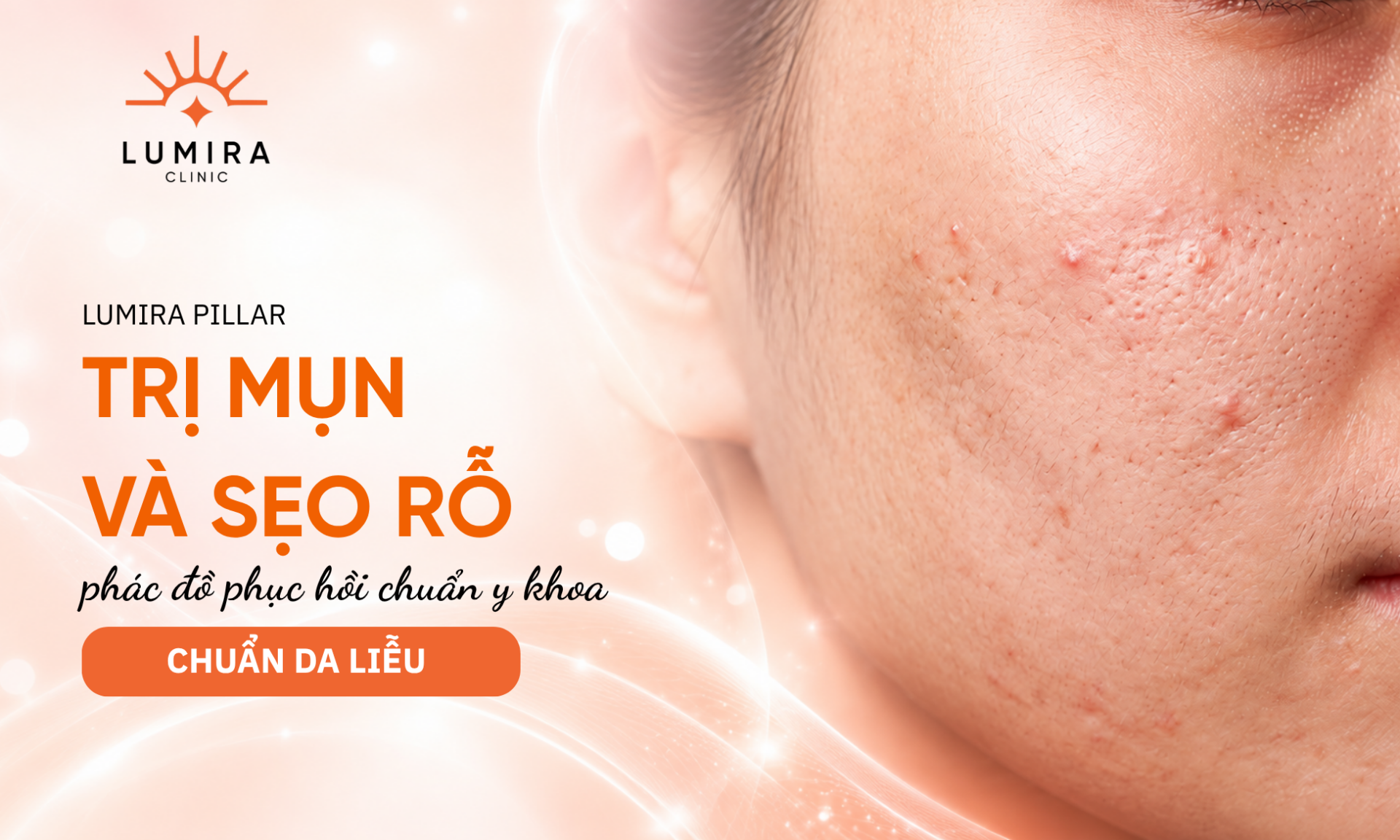 Phac do dieu tri mun va seo ro chuan y khoa phuc hoi da tang tai Lumira Clinic