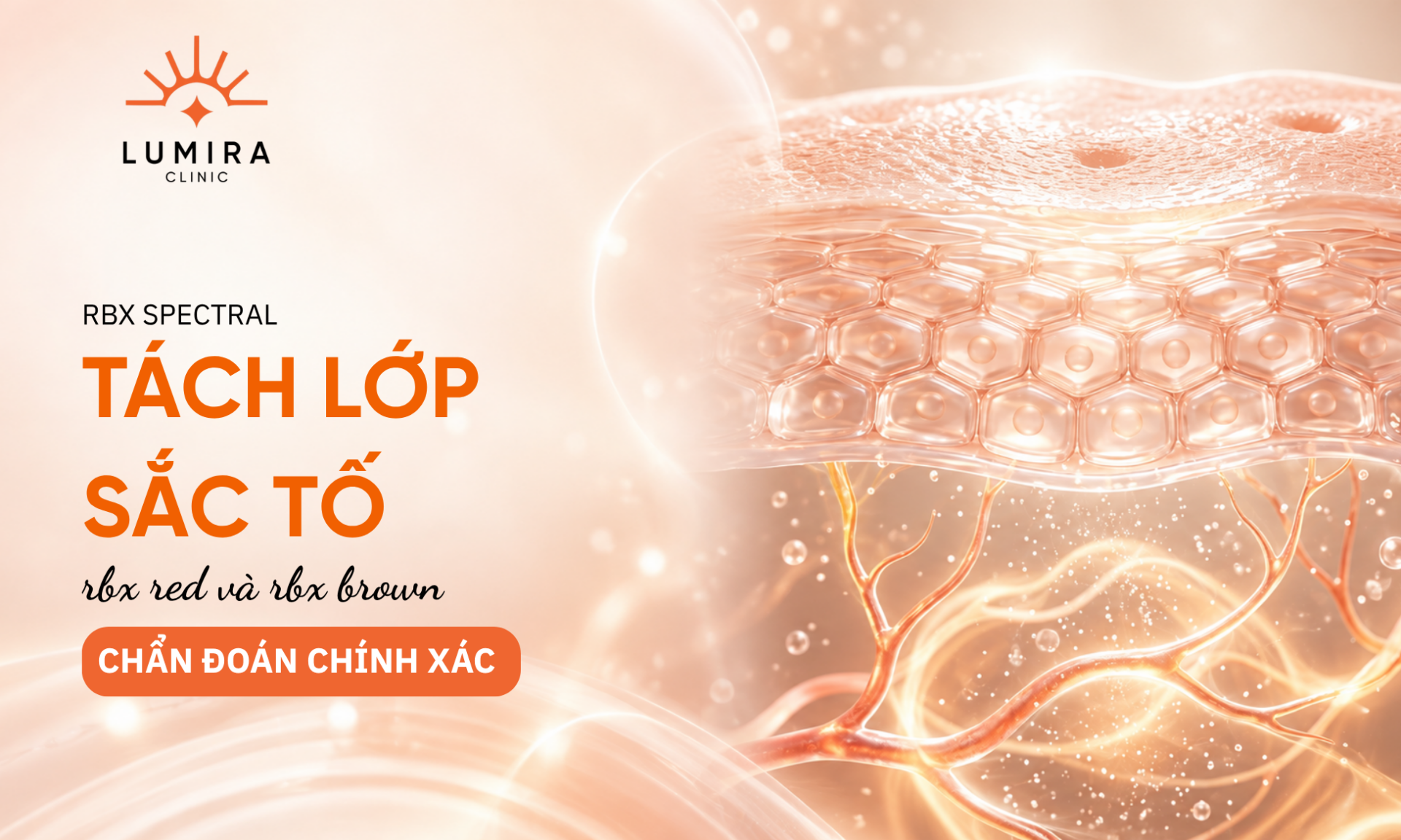 Cong nghe RBX tach lop tham do PIE va tham nau PIH tren may soi da VISIA - Lumira Clinic